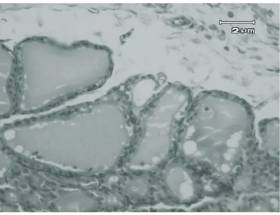 Gambar 5: Gambaran histologi folikel kelenjar tiroid tikus putih kelompok kontrol positif denganperbesaran 400x