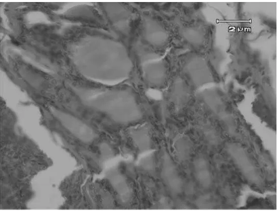 Gambar 7: Gambaran histologi folikel kelenjar tiroid tikus putih kelompok perlakuan VCOdosis 25 mL/hari dengan perbesaran 400x