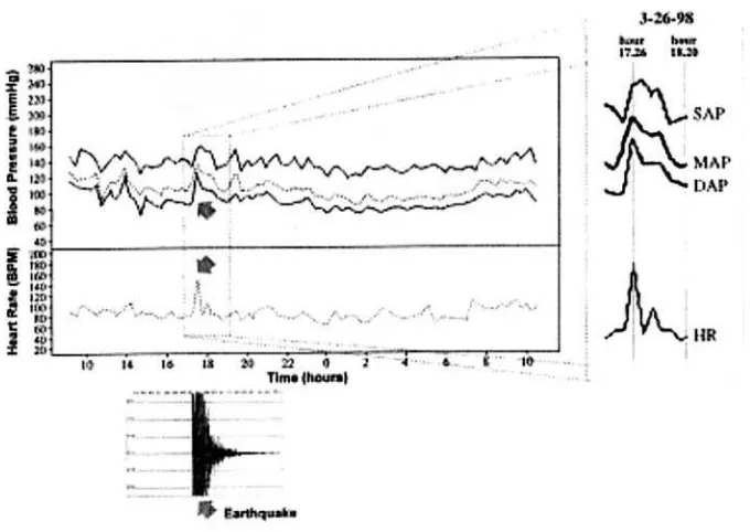 Figure 1.  A record from 24-hour ambulatory blood pressure monitoring in a borderlinehypertensive patient during an earthquake in the Marche and Umbria region, CentralItalia, on March 26, 1998 (the seismograph recording is below the ABPMrecording).7