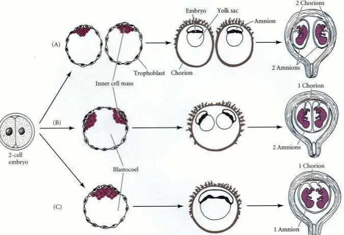 Gambar 3.  Diagram Berbagai Pembelahan Embrio Kembar Monozigot dan Pembentukan Plasenta6
