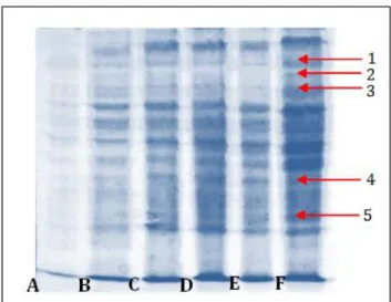 Gambar 4. Profil protein intraseluler isolat bakteri HgP1  pada  pemberian  50  dan  100  ppm  HgCl 2