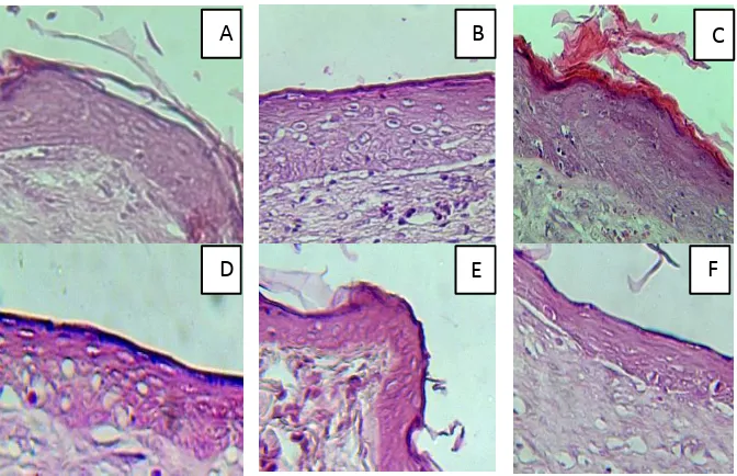 Gambar 3. Gambaran histologi epitel kulit (pipih berlapis): A. Kontrol negatif (tanpa perlakuan); B