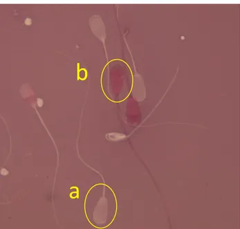 Gambar  2.  Abnormalitas  spermatozoa  diamati  melalui  mikroskop  binokuler  dengan  perbesaran  1000x