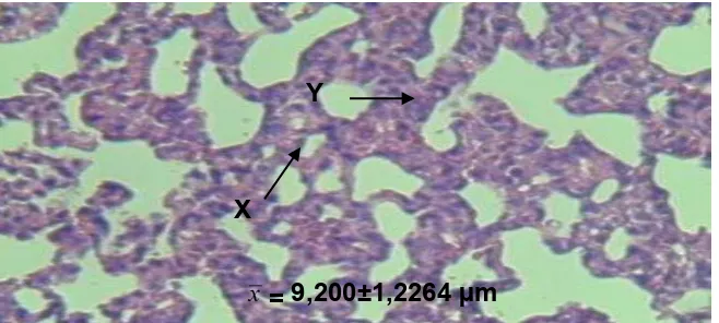 Gambar 3. Histologi Alveolus Kelompok Hewan Uji yang dipaparkan Pengharum Ruangan Berbentuk   Gel 