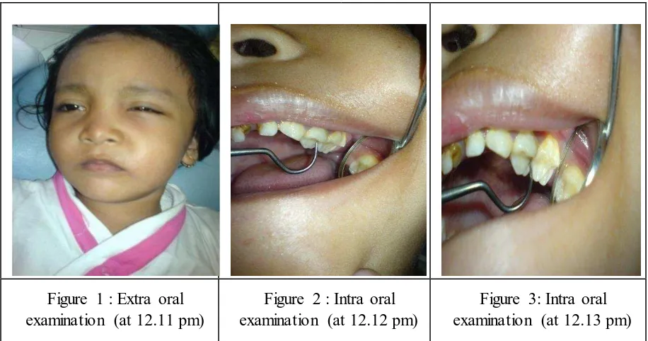 Figure 1 : Extra oral examination (at 12.11 pm)  
