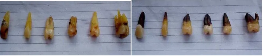 Figure 3. Dental lightness level on group control and treatment before soak in extract rosella 