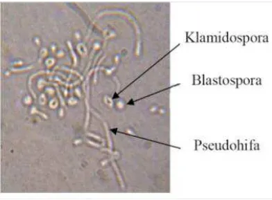 Gambar 5. Koloni Candida albicans (Sumber: Gunawan, 2012) 