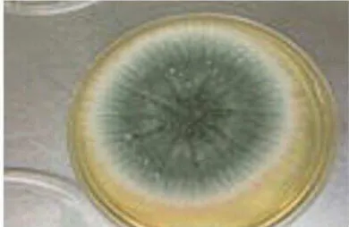 Gambar 8. Sel Aspergillus  (1. Konidia; 2. Sterigmata; 3. Vesikel; 4. Konidiophor; 