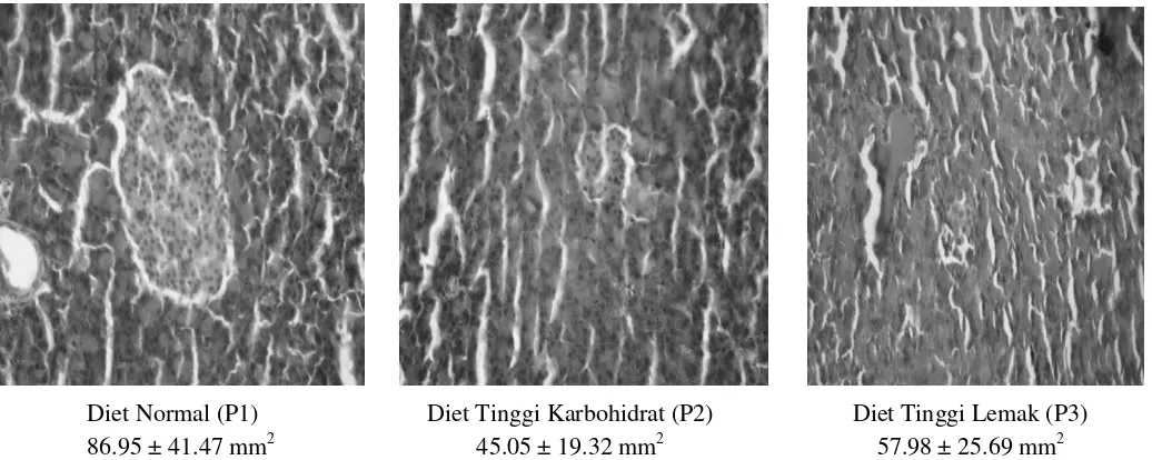 Gambar 1. Perbandingan Kepadatan Sel Beta Pankreas Tikus antar masing-masing kelompok diet (p = 0,000) 