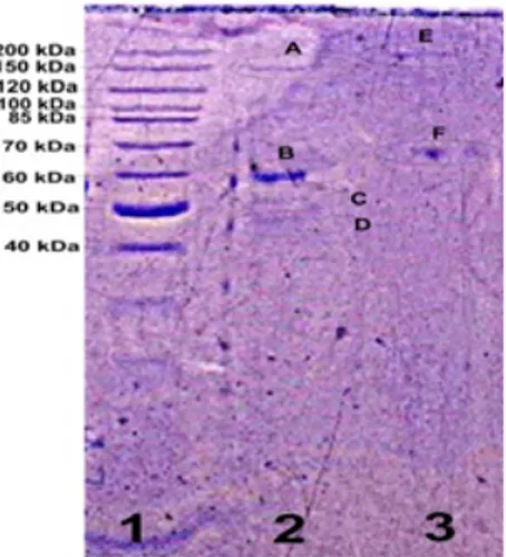 Gambar 2. Karakterisasi antibodi poliklonal yang diperoleh dengan penyuntikan AFM pada kelinci