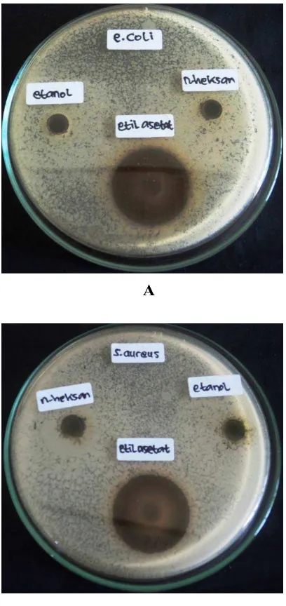 Gambar Hasil Uji Aktivitas Antibakteri Ekstrak n-Heksana, Etilasetat dan Etanol Rumput Laut Coklat Terhadap Bakteri dengan konsentrasi 500 mg/ml 