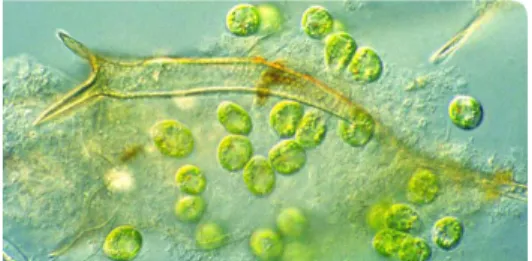 Gambar 2.2. Fitoplankton Jenis Xanthophyta 