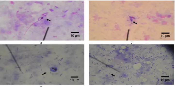 Gambar 1 (a) Myxidium sp., (b) Ceratomyxa sp., (c) Myxobolus sp., dan (d) Henneguya sp.