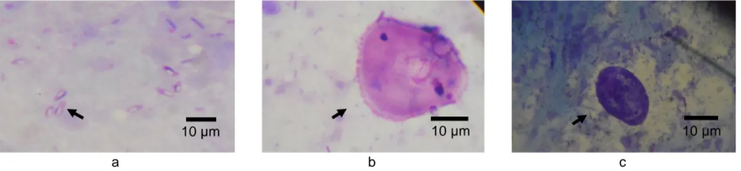 Gambar 2 (a) Glugea sp., (b) Balantidium sp., dan (c) Ceratomyxa sp..             Tabel 1 Tingkat prevalensi protozoa yang menginfeksi ikan sidat (Anguilla spp.) asal Danau Lindu 