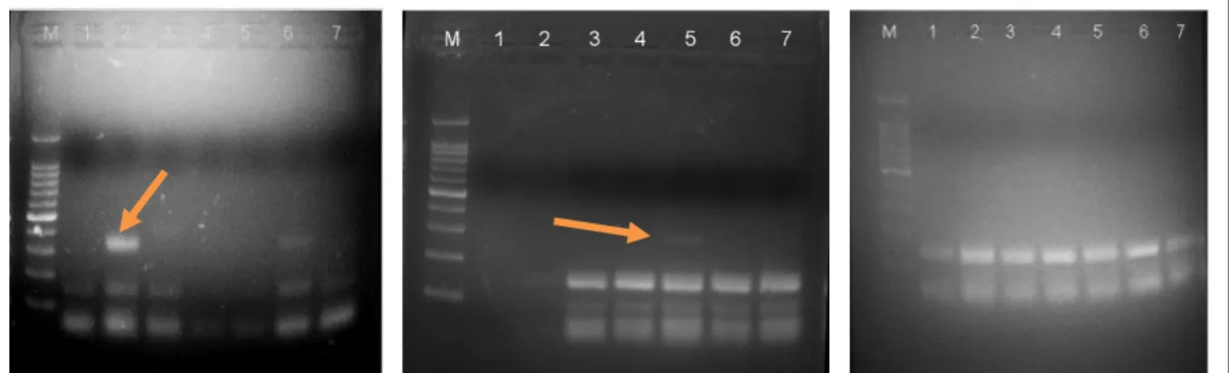 Gambar  1.  Hasil  amplifikasi  PCR  (positif)  sampel  5  ekor  nyamuk/pool  Ma.  uniformis  yang  berasal    dari  Desa 