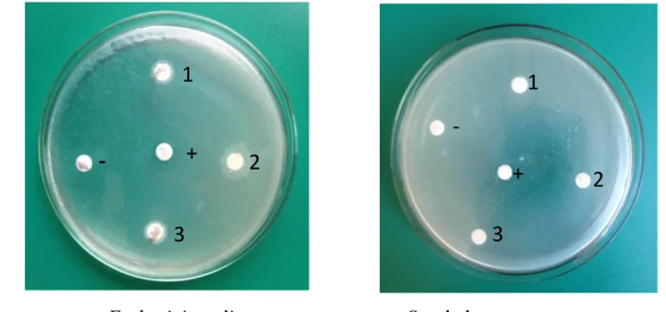 Gambar 1. Uji ekstrak terhadap pertumbuhan antibakteri pathogen. 