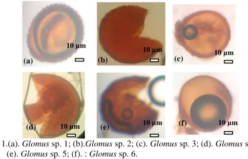 Gambar 1.(a). Glomus sp. 1; (b).Glomus sp. 2; (c). Glomus sp. 3; (d). Glomus sp. 4 (e)