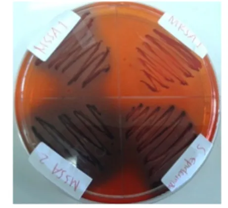 Gambar 1. Perbedaan warna koloni bakteri 