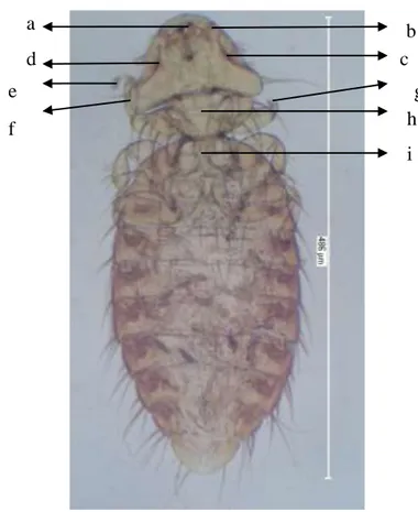 Gambar 4  Kepala M. gallinae pandangan dorsal, (a) mandibula, (b) palpus  maksila, (c) antena 