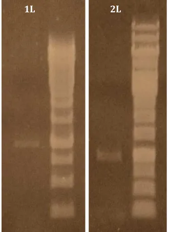 Gambar 2 Elektroferogram Amplifikasi Gen MSP1