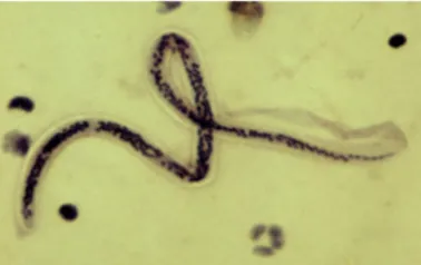 Gambar 3. Mikrofilaria Wuchereria bancrofi 12