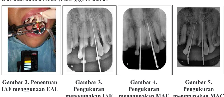 Gambar 2. Penentuan 