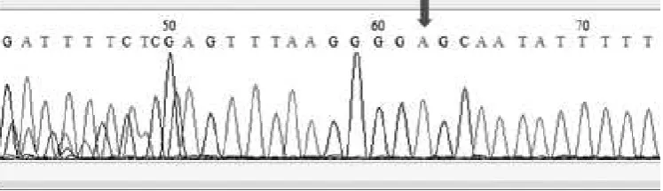 FIGURE 3. Example of electropherogram intron sequencing result DISC1 Leu607Phe gene with the nucleotide A at number 196.339.