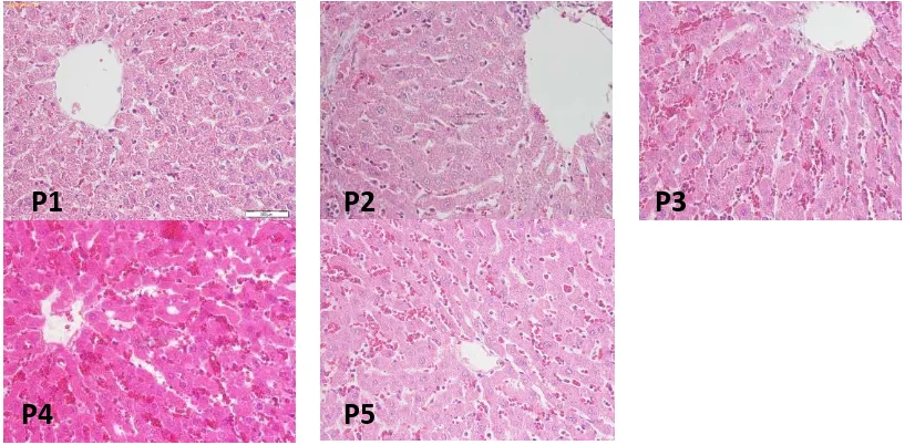 Gambar 2.   Sel hepatosit tikus putih pada semua  perlakuan tampak mempunyai diameter yang berbeda tidak nyata
