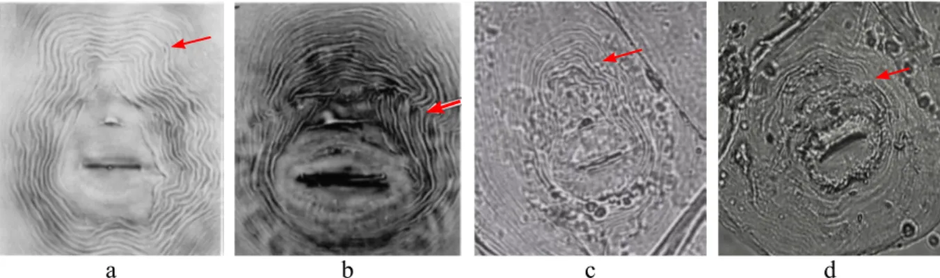 Gambar 2  Pola perineal Meloidogyne spp. a, M. incognita; dan b, M. arenaria berdasarkan  Eisenback et al