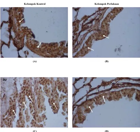 Gambar 1. Ekspresi AgNORS yang menunjukkan sel-sel yang berproliferasi pada epitel bronkiolus mencit pada minggu ke-8 (A1) dan ke-26 (A2)