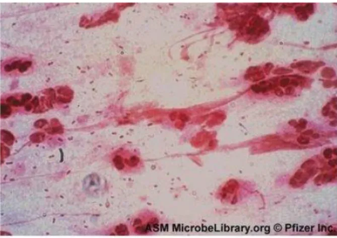 Gambar 1. H.influenzae yang berasal dari sputum, tampak  sebagai Gram-negatif  coccobacilli