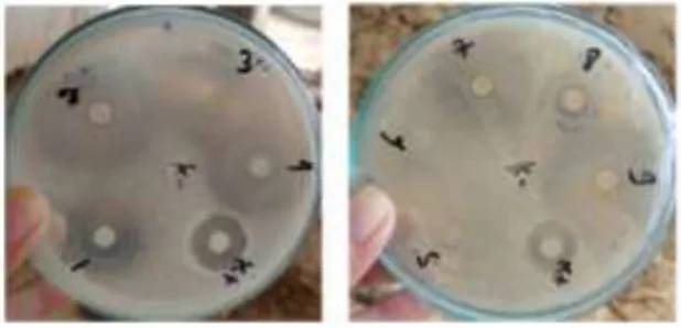 Gambar 1. Hasil uji zona hambat isolat Bakteri Simbion terhadap MRSA. 1 (Isolat HS1), 2  (Isolat HS2), 3 (Isolat HS3), 4 (Isolat HS4), 5 (Isolat HS5), 6 (Isolat HS6), 7 (Isolat HS7), 8 