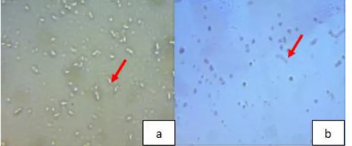 Gambar 1. Pewarnaan probiotik dengan perbesaran  400  kali:  a)  Lactobacillus  bulgaricus  biakan;  b)  Lactobacillus  bulgaricus  murni 