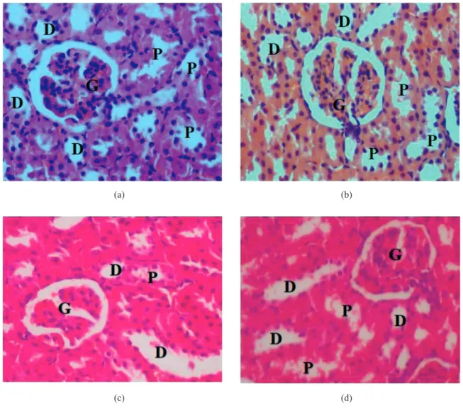 FOTO  2. Histologi ginjal tikus (A) kawalan dan (B) kumpulan  LAB  bagi kumpulan ketoksikan oral akut; (C) kawalan (D) LAB bagi 