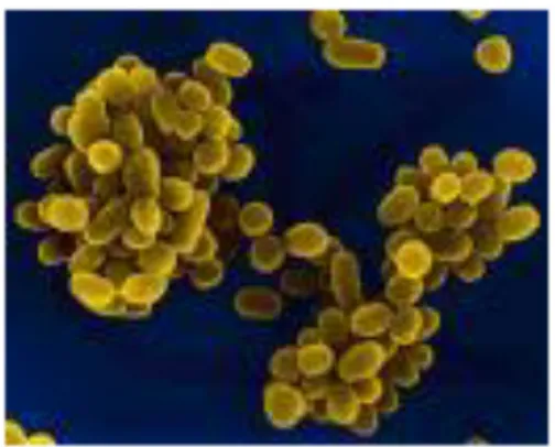Gambar 2. Bakteri Brucella Abortus        Jumlah  kejadian  brucellosis  pada  manusia  sebenarnya  belum  diketahui  secara  pasti,  tetapi  berdasarkan  laporan  kejadian  penyakit  di  daerah  endemis  bervariasi  yaitu  0,01 –200  kasus  per  100.000  