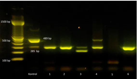 Gambar 1 Hasil elektroforesis sampel PCR. Keterangan : 1. Sampel limpa D1; 2. Sampel limpa D6; 3