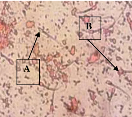 Gambar 1. Viabilitas spermatozoa A: spermatozoa hidup, B: Spermatozoa Mati  (Perbesaran 10x40) 