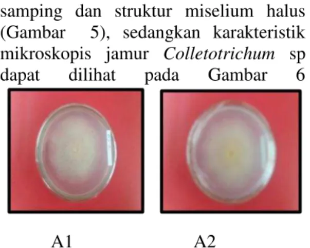 Gambar  6  .  Karakteristik    Mikroskopis  jamur  Colletotrichum  sp.    a.  =  hifa  ,  b
