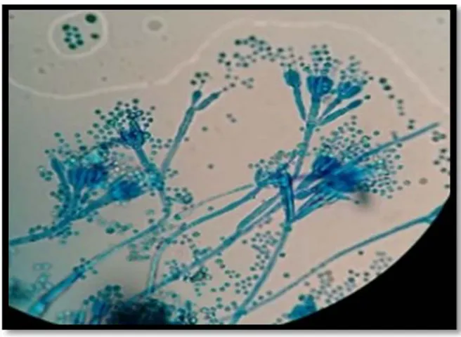 Gambar 4.  Penicillium citrinum  pada 100 kali pembesaran. Figure 4. Penicillium citrinum at 100 times enlargement.