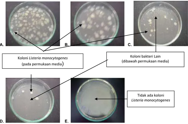 Gambar 2.  Koloni Listeria monocytogenes pada media blood agar; Merck (Pengenceran 10 -1 )