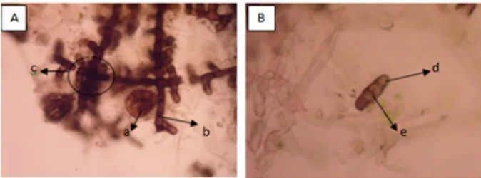 Gambar 1. Morfologi mikroskopis jamur  