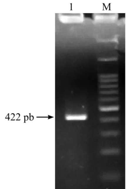 Gambar 2  Visualisasi fragmen DNA hasil RT- RT-PCR TMVdari sampel daun anggrek bergejala  di Sleman, Yogyakarta