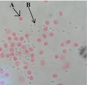 Gambar 1. Pewarnaan spermatozoa menggunakan eosin, pengamatan dengan  mikroskop compound dengan perbesaran 1000 X