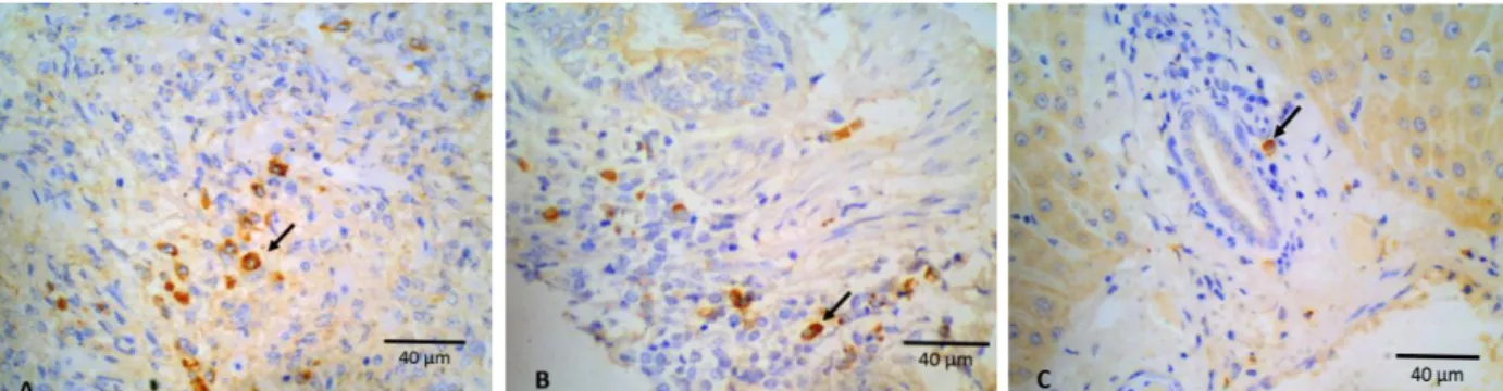 Gambar 1. Hasil pewarnaan imunohistokimia. Warna coklat menunjukkan hasil imunoreaktif pada sel-sel makrofag