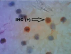 Gambar 1. Gambaran imunositokimia leukosit mencit kontrol dengan perbesaran 1000x (kiri), memperlihatkan warna                    biru pada sitoplasma maupun nukleus (negatif antigen dengue).