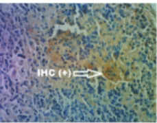 Gambar 7. Gambaran imunohistokimia lien mencit perlakuan pada perbesaran 400x, memperlihatkan sitoplasma berwarna                    coklat (positif antigen dengue) pada hari ke-13 p.i