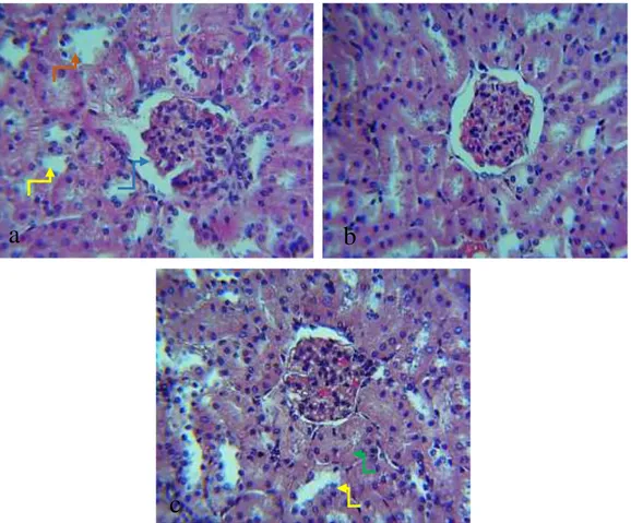 Gambar 2.  Mikroanatomi  ginjal  tikus  pada  berbagai  kelompok  esktrak  buah  lakum  memperlihatkan  adhesi  glomerulus (panah biru), lumen tubulus kontortus proksimal konstriksi (panah hijau), lumen tubulus  kontortus  proksimal  dilatasi  (panah  kuni