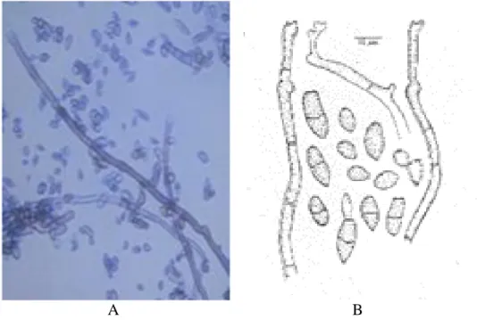 Gambar 6. (A) Mikroskopik Fusarium culmorum (perbesaran 400x),  (B) struktur Fusarium culmorum (Sumber: Samson dkk, 1984, halaman 82, 83)