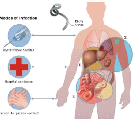 Gambar 5. Mekanisme Infeksi Virus Ebola 