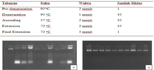 Gambar 3  Contoh hasil ekstraksi DNA Sengon. Ket: (a) DNA Sengon yang diekstraksi dengan Buffer CTAB  dan dilakukan pengenceran, (b) DNA Sengon yang diekstraksi dengan Kit GenElute